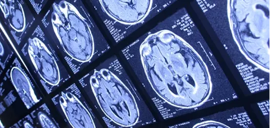Rows of square screens showing MRI brain scans